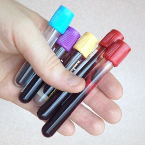 Vacutainer_blood_bottles